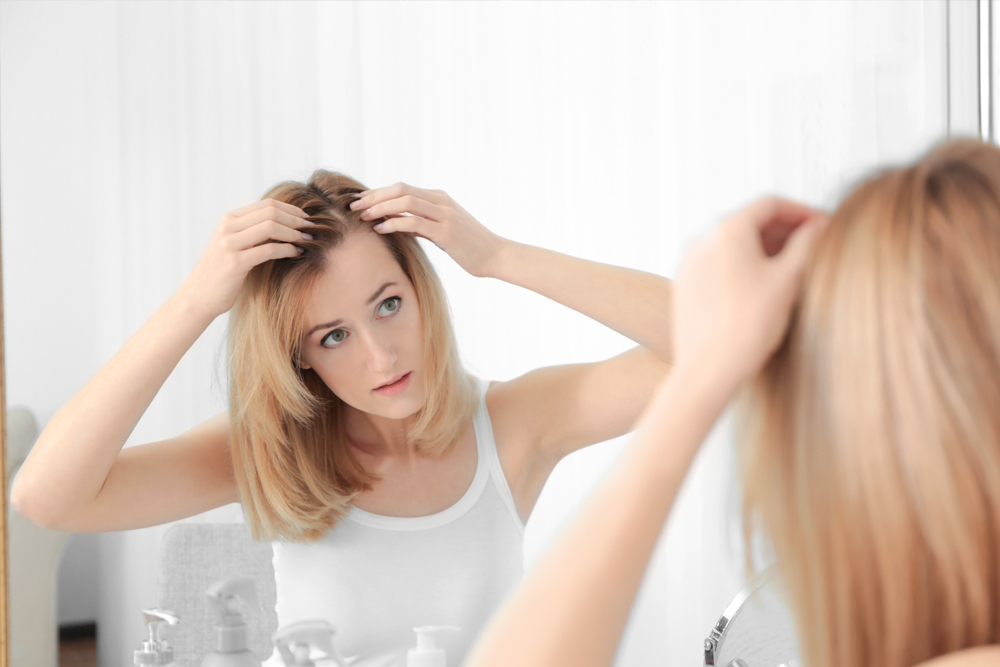 woman with alopecia